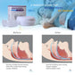 Anti-Snoring Mouth Guard -by RD